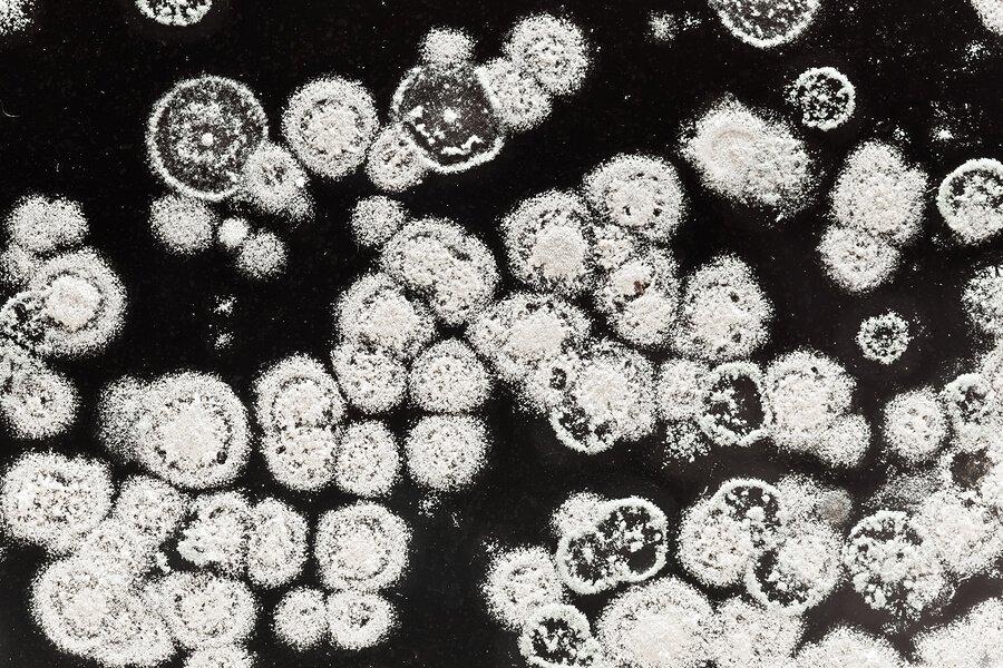 microscopic mold spores